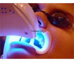 Blanqueamiento dental laser - 1/1